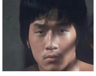 探尋小巷中的美麗秘密，割雙眼皮的價(jià)格是否昂貴？